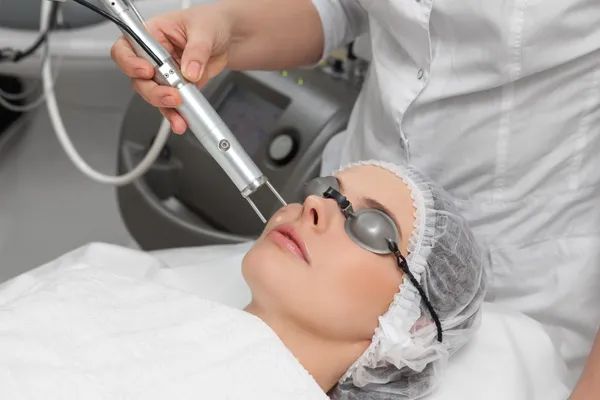 1 sesión Laser CO2 rostro
