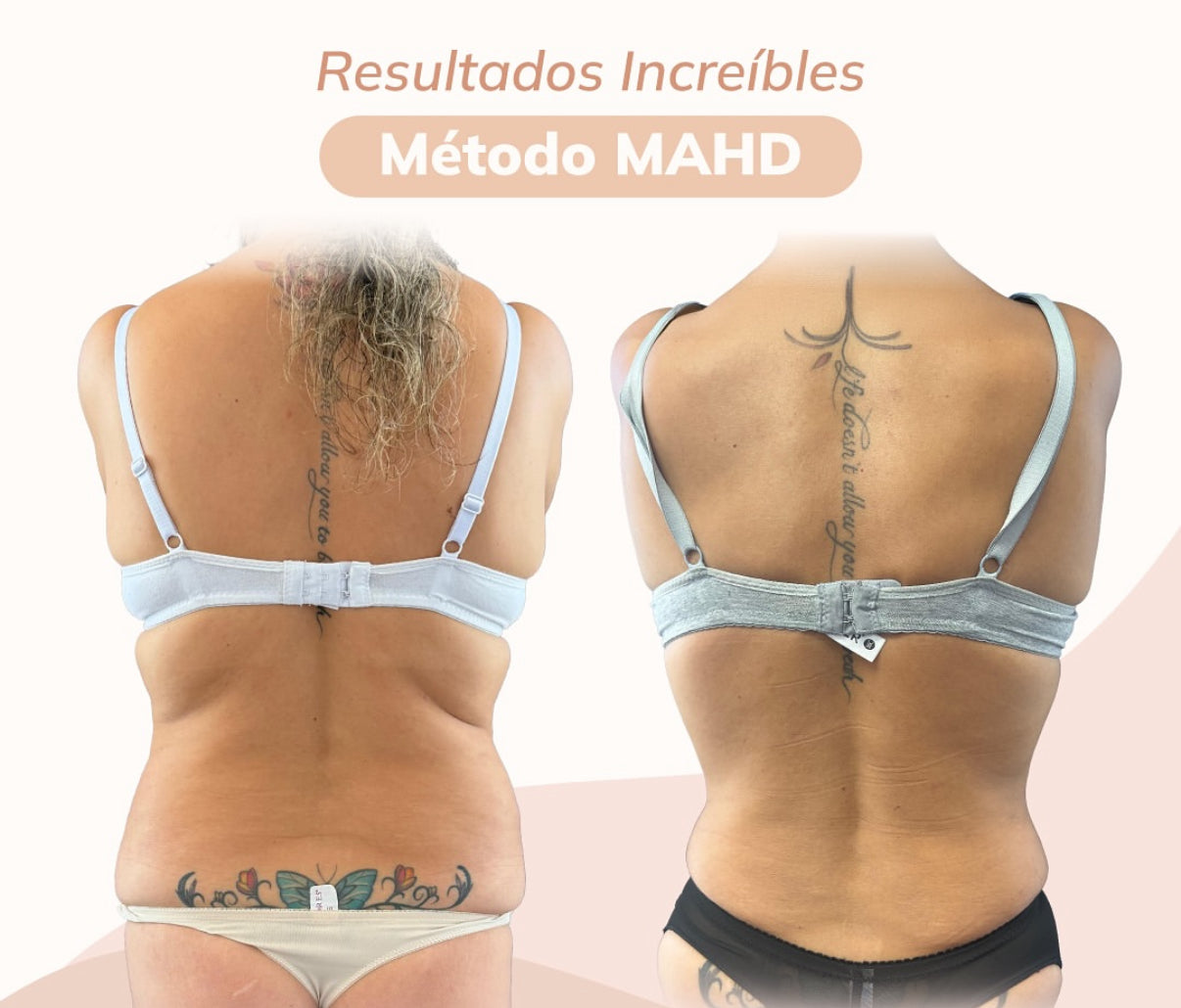 Armonización método MAHD