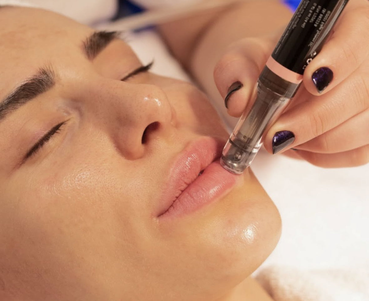 Hydrafacial labios Perk Lip