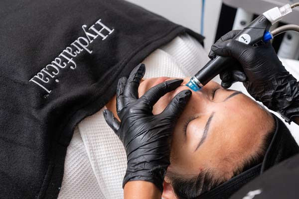 Hydrafacial Syndeo 1 sesión Platinium