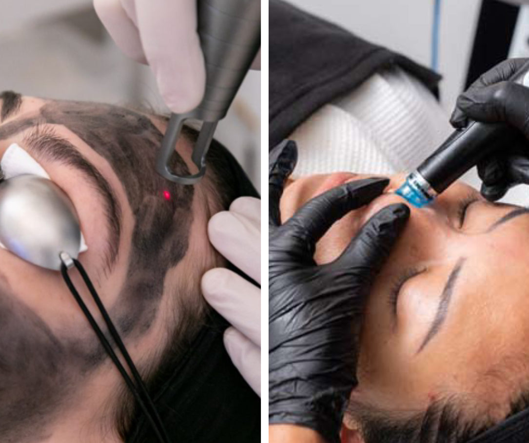 1 Hollywood peel + 1 sesión Hydrafacial Syndeo