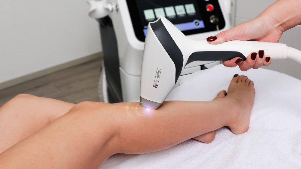 Depilación láser en glúteos e intergluteo.