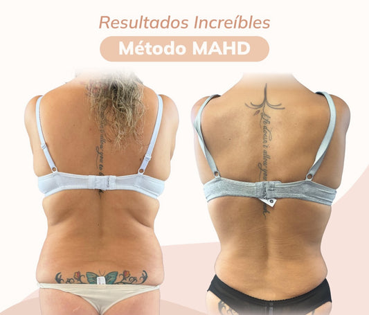Armonización método MAHD