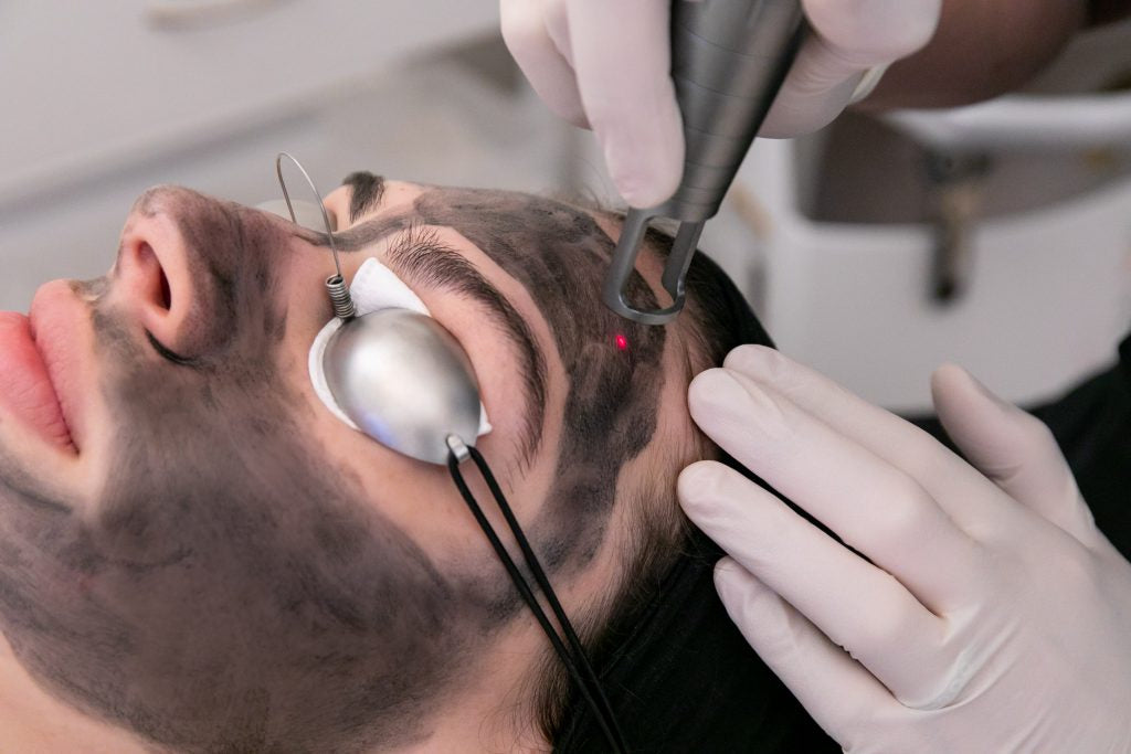 Hollywood laser peel 3 sesiones